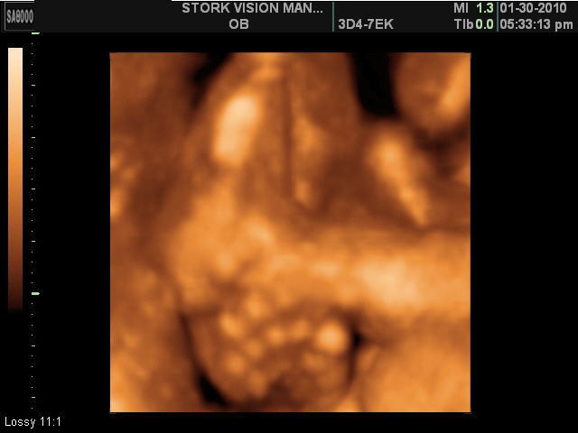 [Baby+Feet.jpg]
