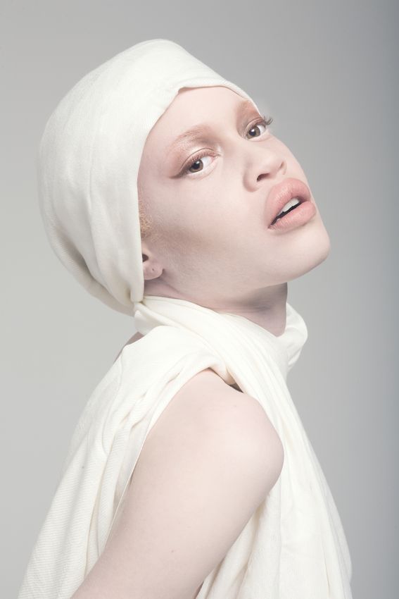 Model Albino