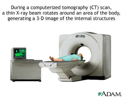Ct+scan+machine+brands