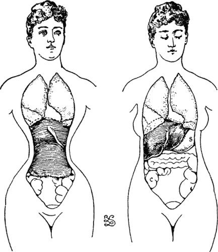 [corset.bmp]
