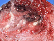 Gastritis hemorrágica (canino, uremia)