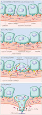 Degradaciónde la membrana basal