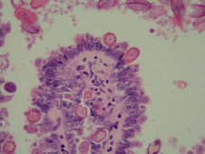 Formas parasitarias de Eimeria en epitelio biliar