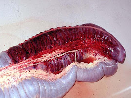 Infarto en colon (equino)