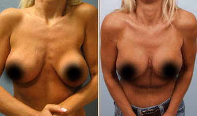 ��������� ���������� �����