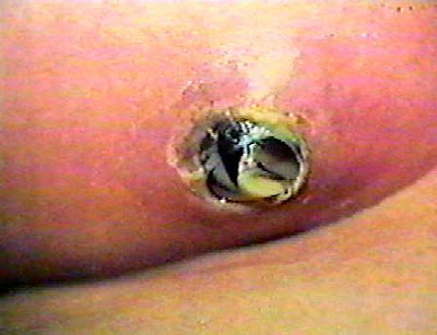 ���������� ����� ����������