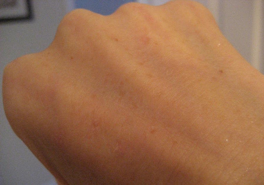 Chemical Peels for Acne and Anti Aging Spot treatment for hands