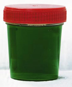 blue urine