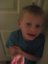 Camerons First Lose tooth