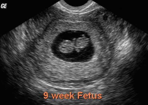 wallpaper hot 9 weeks pregnant