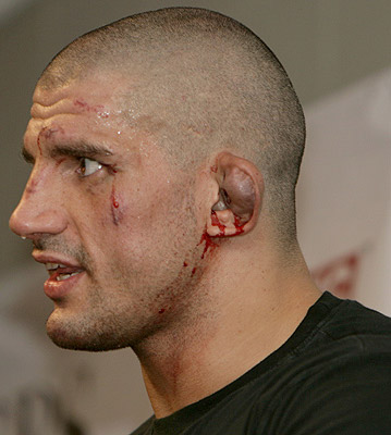 Disgusting Ear