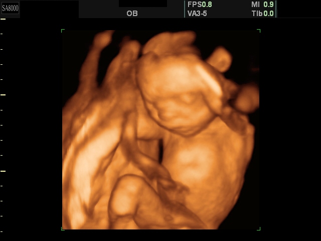 God, Guns and Motherhood! Abortion