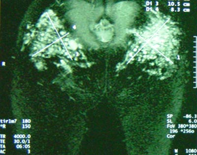 [reacción+a+los+biopolimeros.jpg]