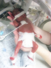 Remembering Logan William Glunt