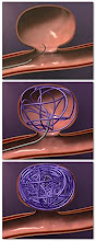 Manejo Anestésico en Terapia Endovascular Neurológica