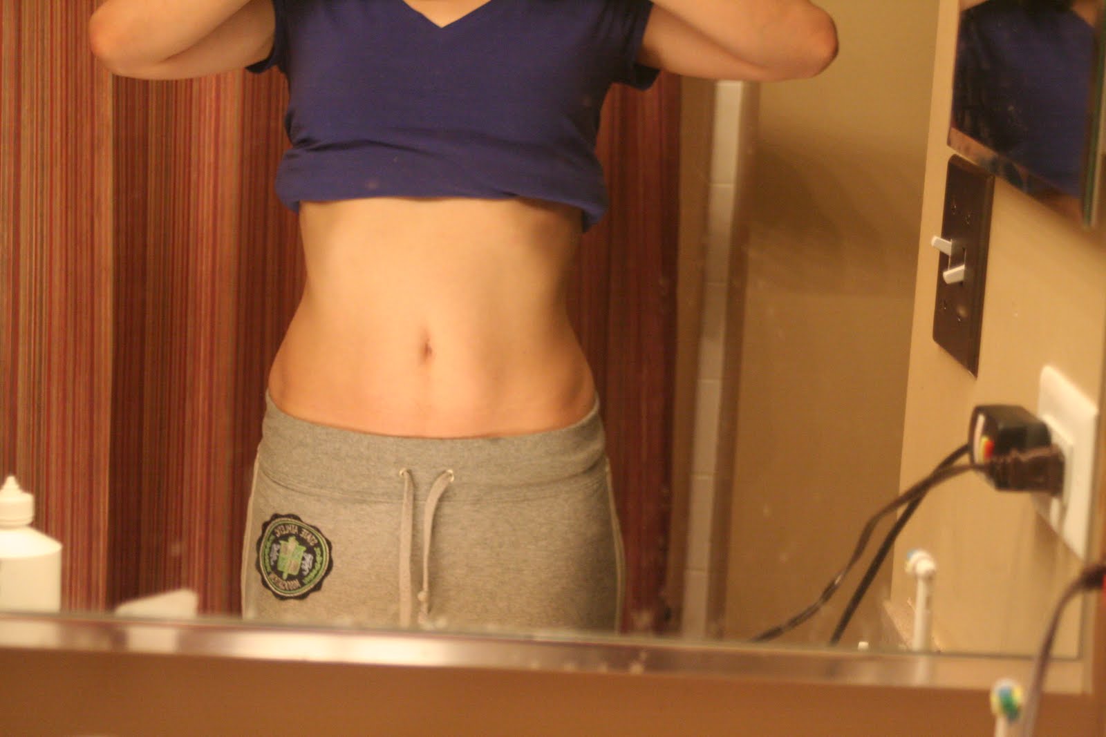 Diastasis Recti Repair