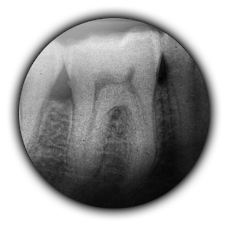 Dental Radiologi