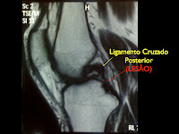 LLCP+LES%C3%83O.001.jpg