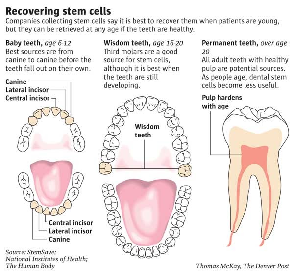 32 Gems STEM CELL BANK SOURCEDECIDUOUS (MILK) TEETH