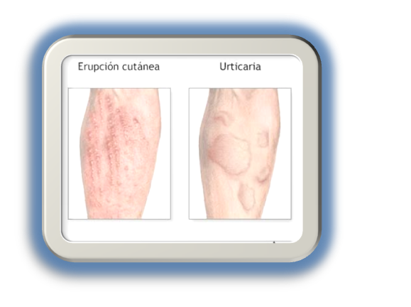 Portal Médico: SHOCK ANAFILÁCTICO Portal Médico: SHOCK ANAFILÁCTICO