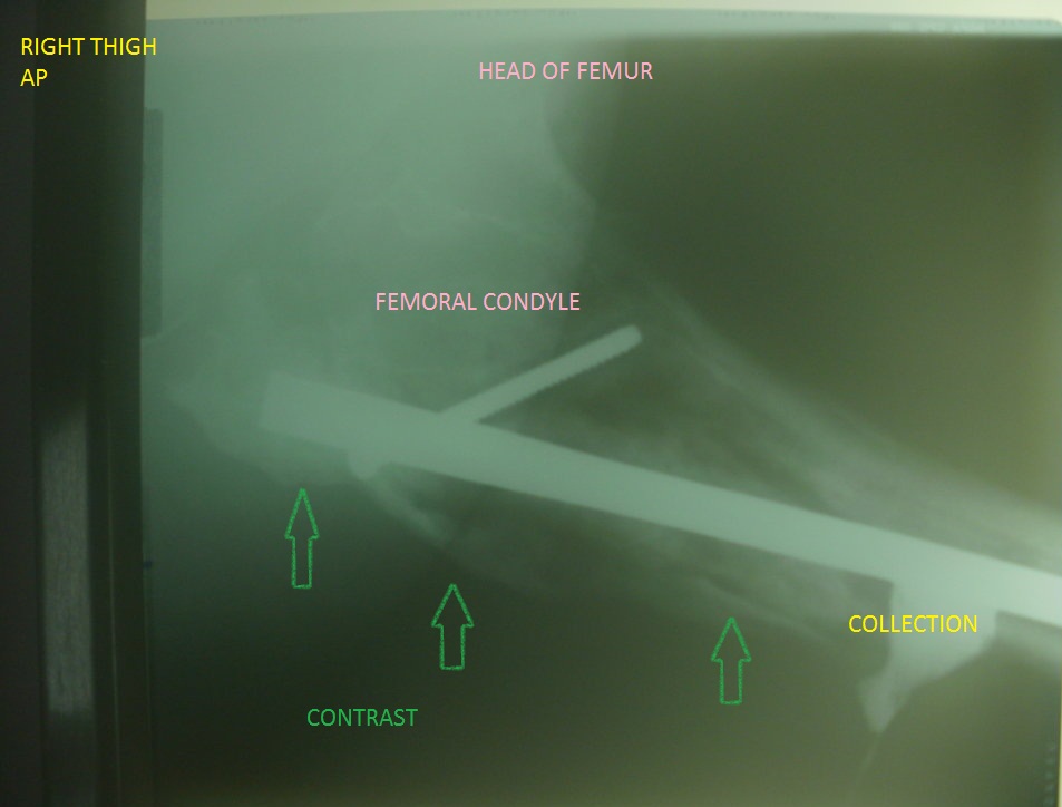 RadiologySpirit sinogram