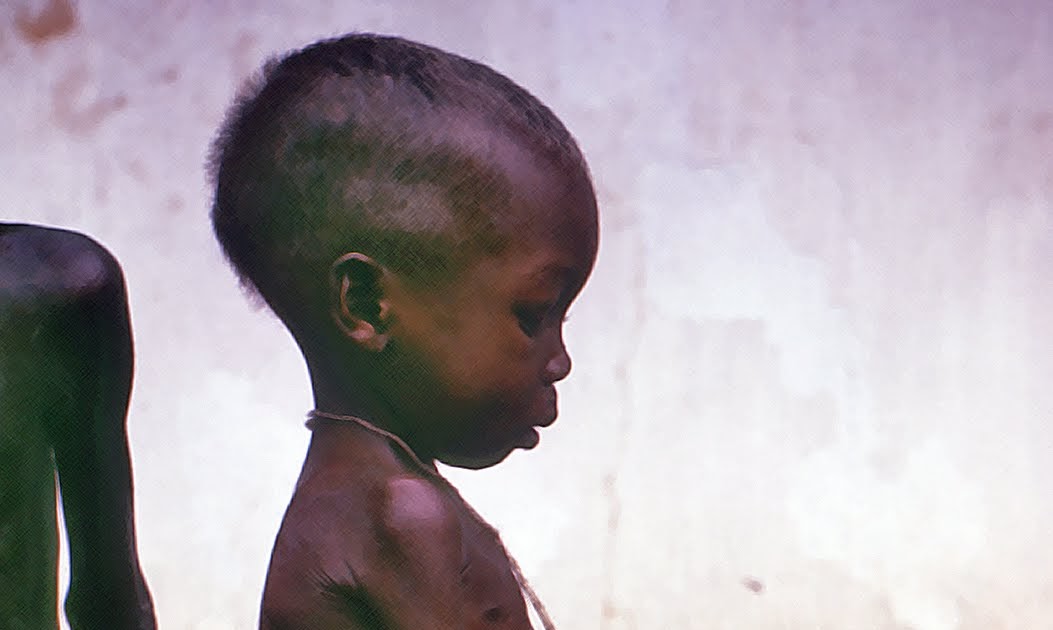 URBANRES.: HAMBRE : DEFINICION Y CARACTERISTICAS : HUNGER URBANRES.: HAMBRE : DEFINICION Y CARACTERISTICAS : HUNGER