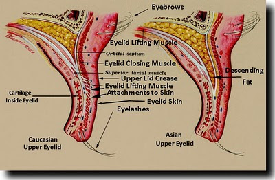 asian-upper-eyelidBlog1.jpg