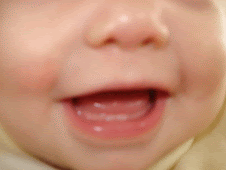 My First 2 Teeth!