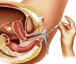 Causes of less sperm amazing