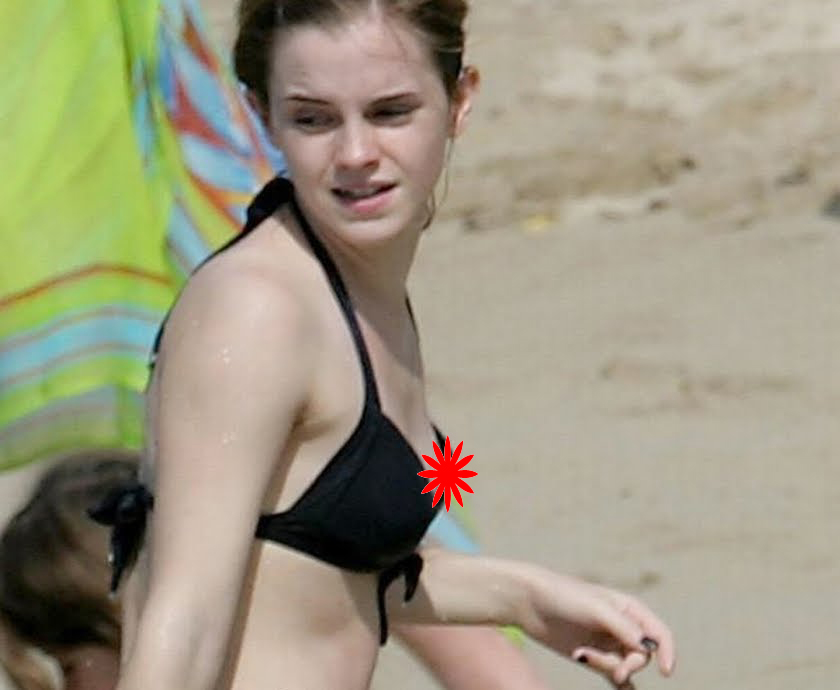 watson wardrobe malfunction 1 min 8 jul 2009 emma watson on wardrobe