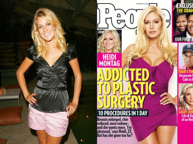 heidi montag before and after all surgery. Heidi Montag Ashlee Simpson