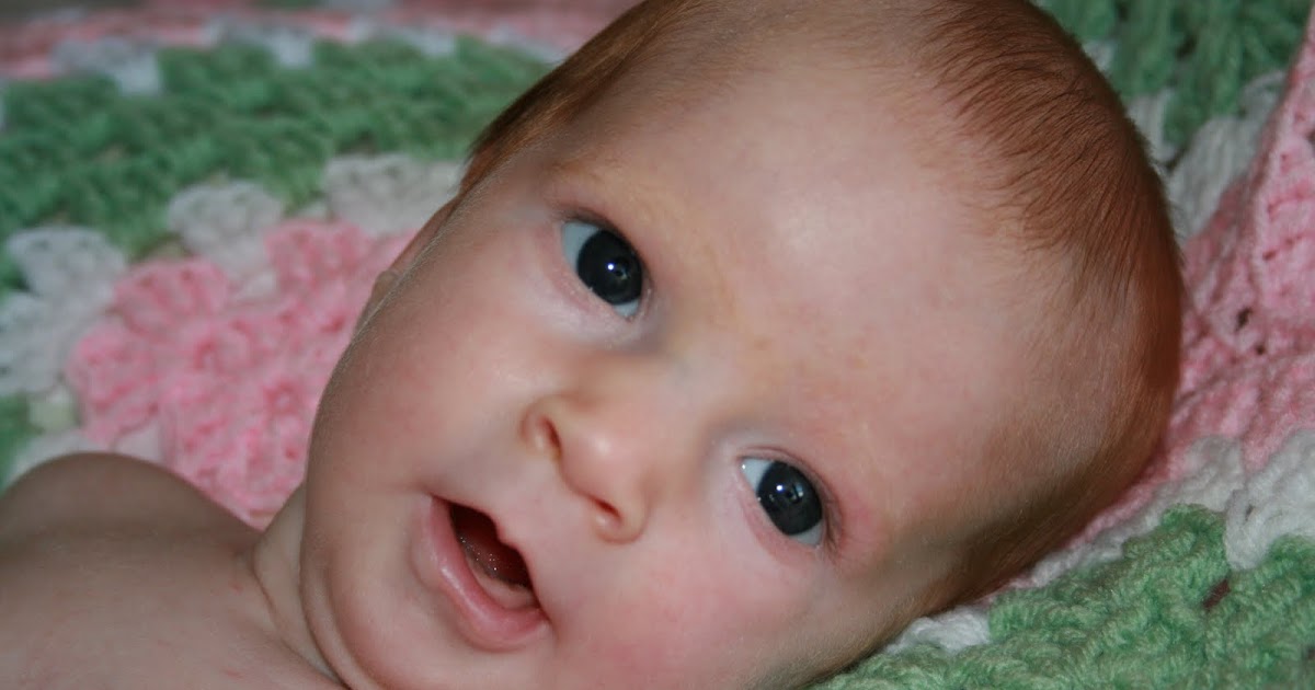 Stunning Portraits: The Beauty And Strength Shown In **Prader Willi Syndrome Pictures**. - 3x545h1