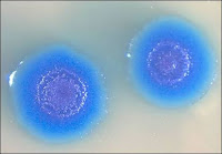 Mycoplasma mycoides transformées. Doc. Graig Venter
