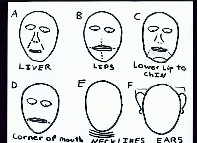 Facial Diagnosis I