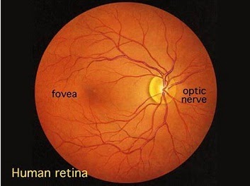 vision loss normal lens normal retina vision loss normal lens normal retina