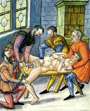 castrated a 57-year-old man after discovering he was having a