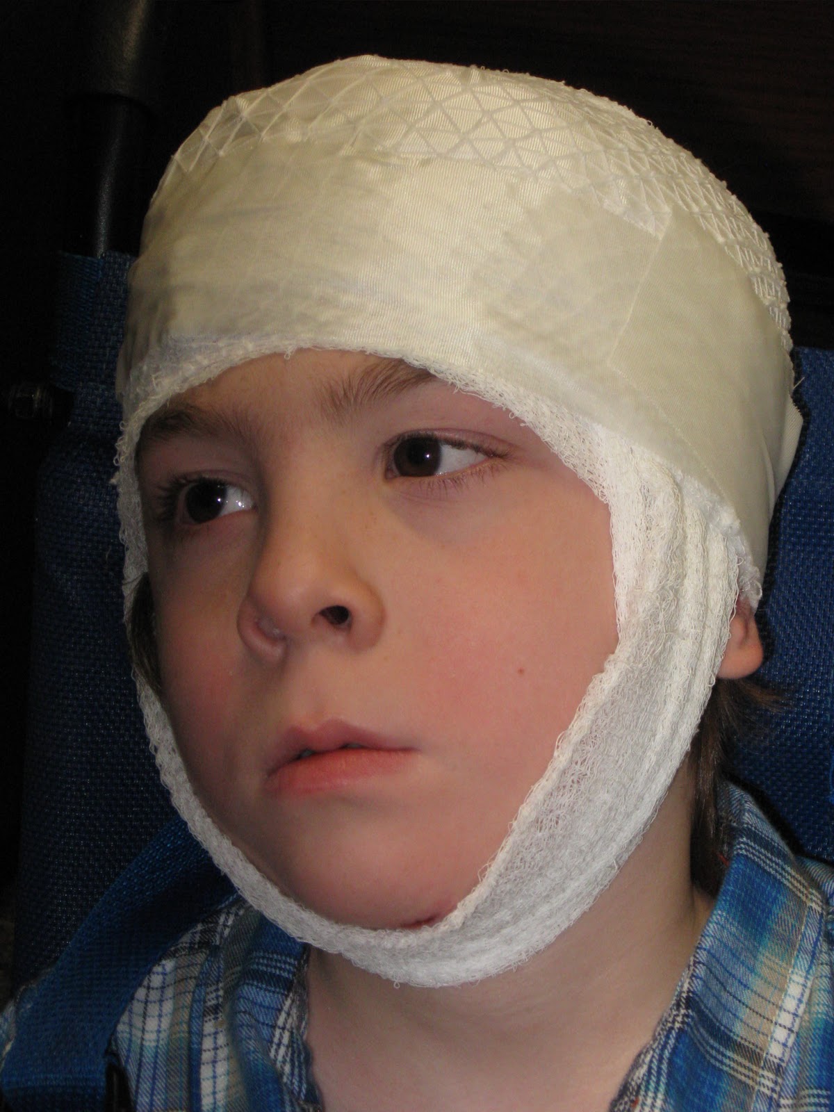 What Is Gauze