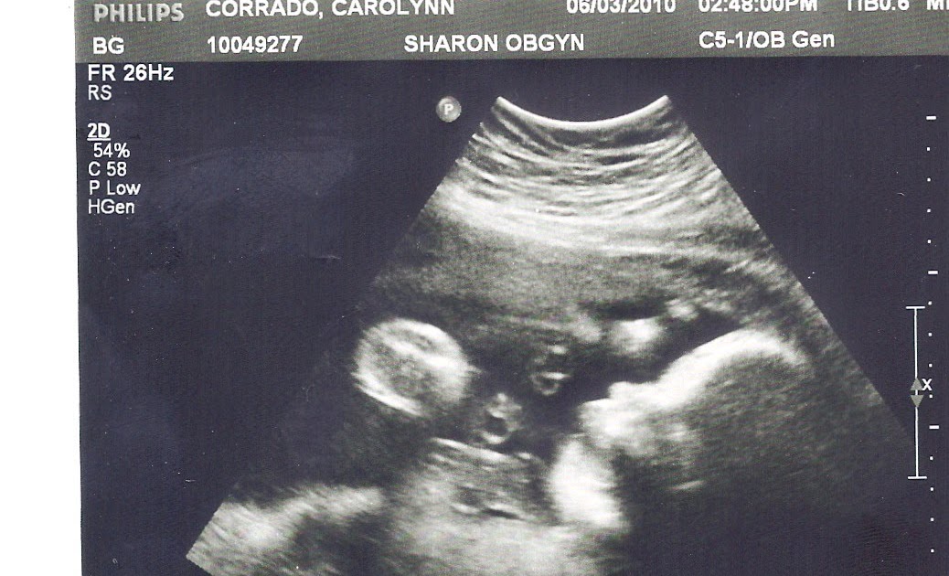 Maier Family Happenings: 30.5 Week Ultrasound Pictures!