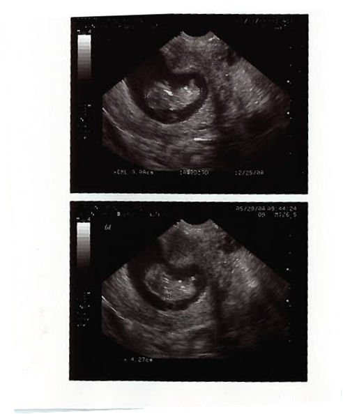 [@+10+weeks.png]