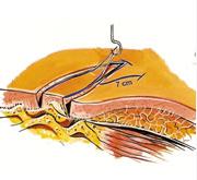 [cirurgia.JPG]