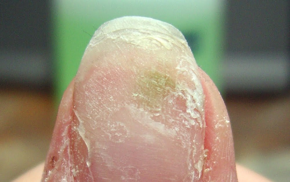 Colour Victim A little word for those of you with acrylic nails.