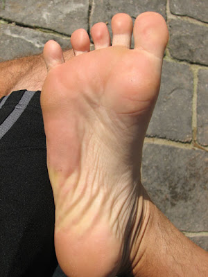 Gnarly Feet