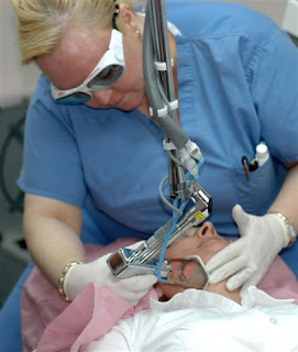 Laser Skin Treatment