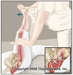 Treating gluteus minimus with Clinical Thai Bodywork