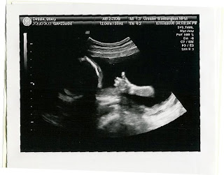 ultrasound thumbs up
