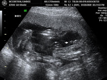 It's a boy!