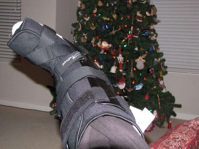 Fracture Boot before surgery
