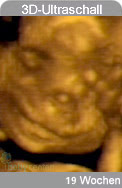 19 weeks 3D ultrasound image