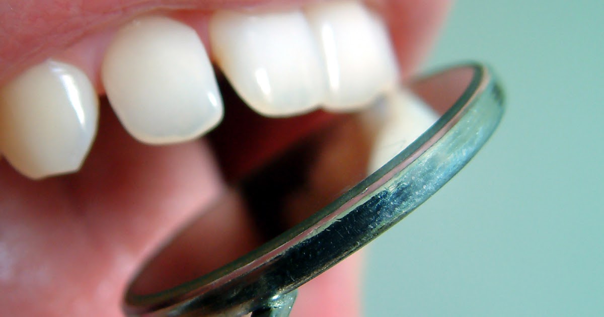 Cosmetic Dentistry Edinburgh Smile Makeover Tips From An Edinburgh Dentist