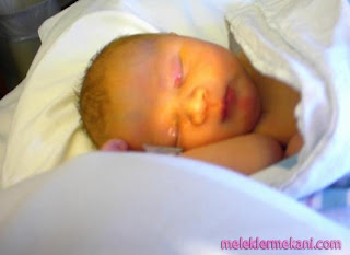 yenidogan bebeklerde sarilik belirtileri ve tedavisi bir nefes sihhat